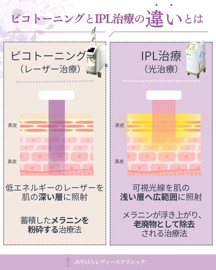 IPLシミ取り光治療　｜熊本市 みやはらレディースクリニック 美容診療専用サイト