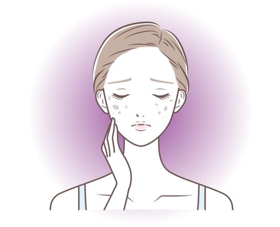 顔のシミ取りを熊本で検討中の女性必見！美容医療でのシミ取りの効果を高める事前準備3選 ｜ 熊本市 みやはらレディースクリニック 美容診療専用サイト