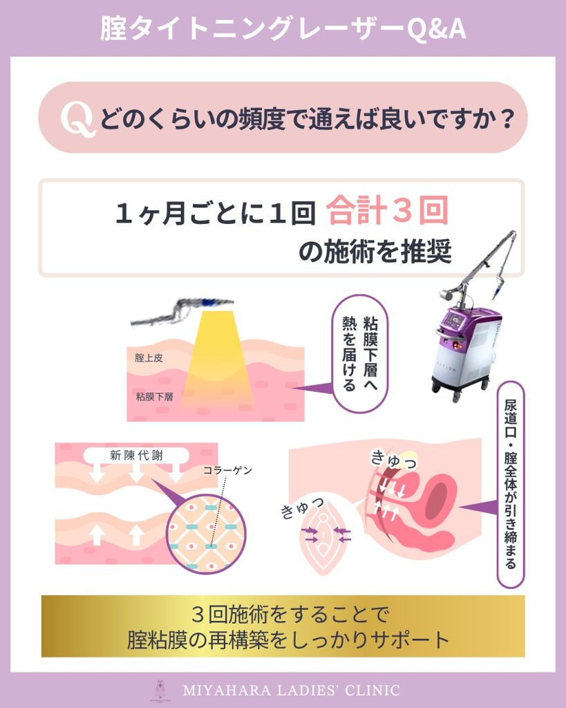膣レーザー　【熊本で膣レーザー】ハリ・潤いを取り戻す注目のフェムケア｜仕組み・効果・回数を徹底解説｜熊本市 みやはらレディースクリニック 美容診療専用サイト