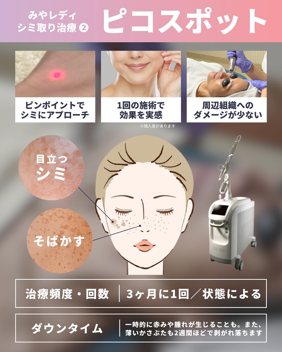ピコスポットによるシミ治療の特徴として、目立つシミやそばかすの適応症状、治療頻度、かさぶた等のダウンタイムを女性のイラスト付きでまとめた解説図。