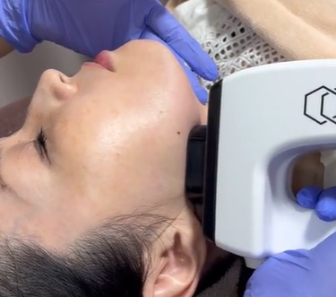 毛穴のたるみ治療って何をする?縦毛穴の原因と美容医療でのたるみケア|熊本市 みやはらレディースクリニック 美容診療専用サイト