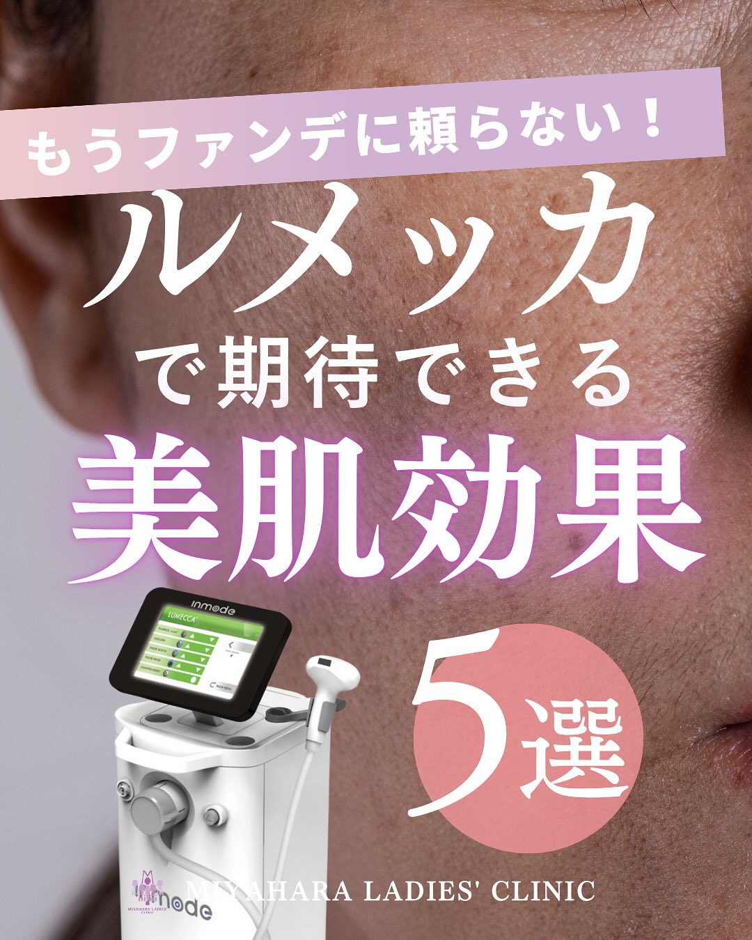 ルメッカ効果が話題なのはなぜ？幅広いアプローチや施術後の経過を解説！｜熊本市みやはらレディースクリニック