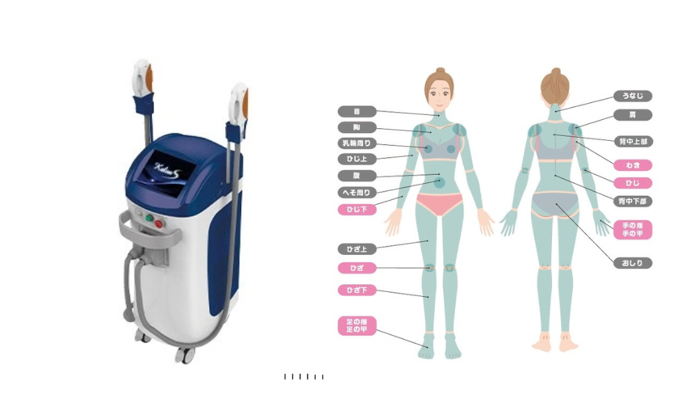 医療脱毛何回でツルツルになる？熊本で検討中の方へ｜部位ごとの違いや効率アップのポイントを医師監修で解説｜熊本市みやはらレディースクリニック
