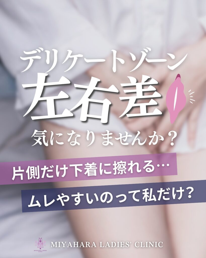びらびらが片方だけ大きいのは大丈夫？原因・よくある悩み・施術方法を熊本の婦人科が解説