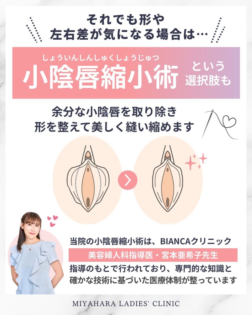びらびらが片方だけ大きいのは大丈夫？原因・よくある悩み・施術方法を熊本の婦人科が解説