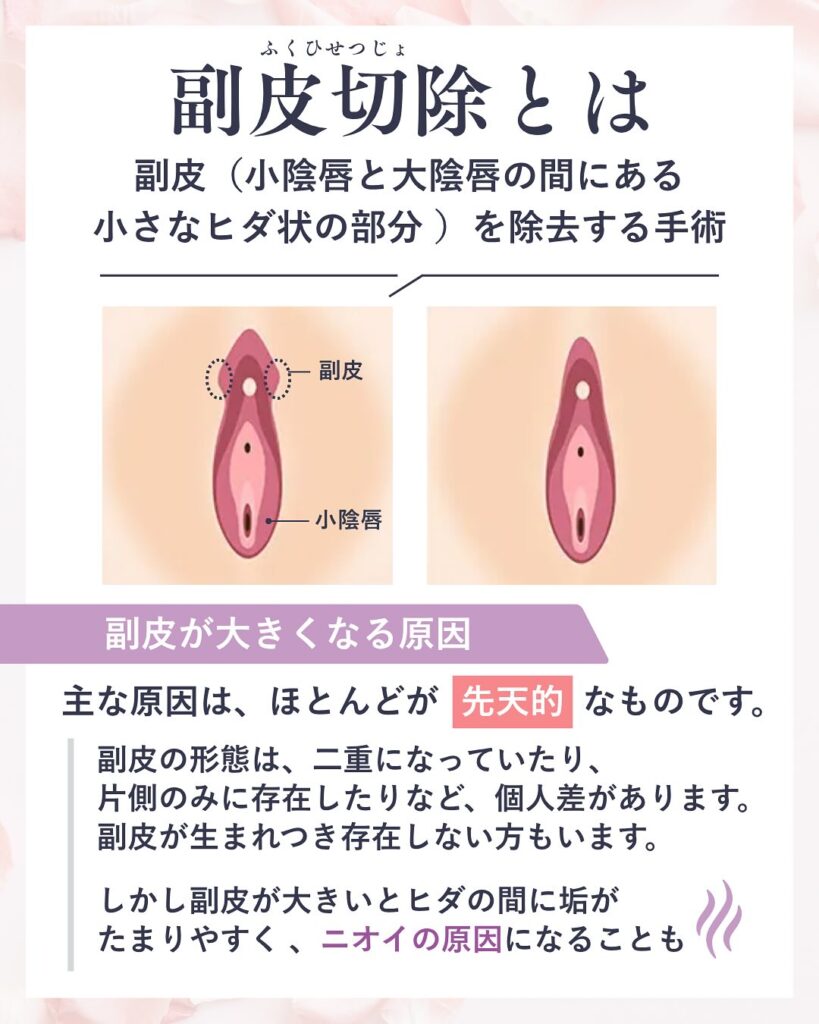 びらびらが片方だけ大きいのは大丈夫？原因・よくある悩み・施術方法を熊本の婦人科が解説
