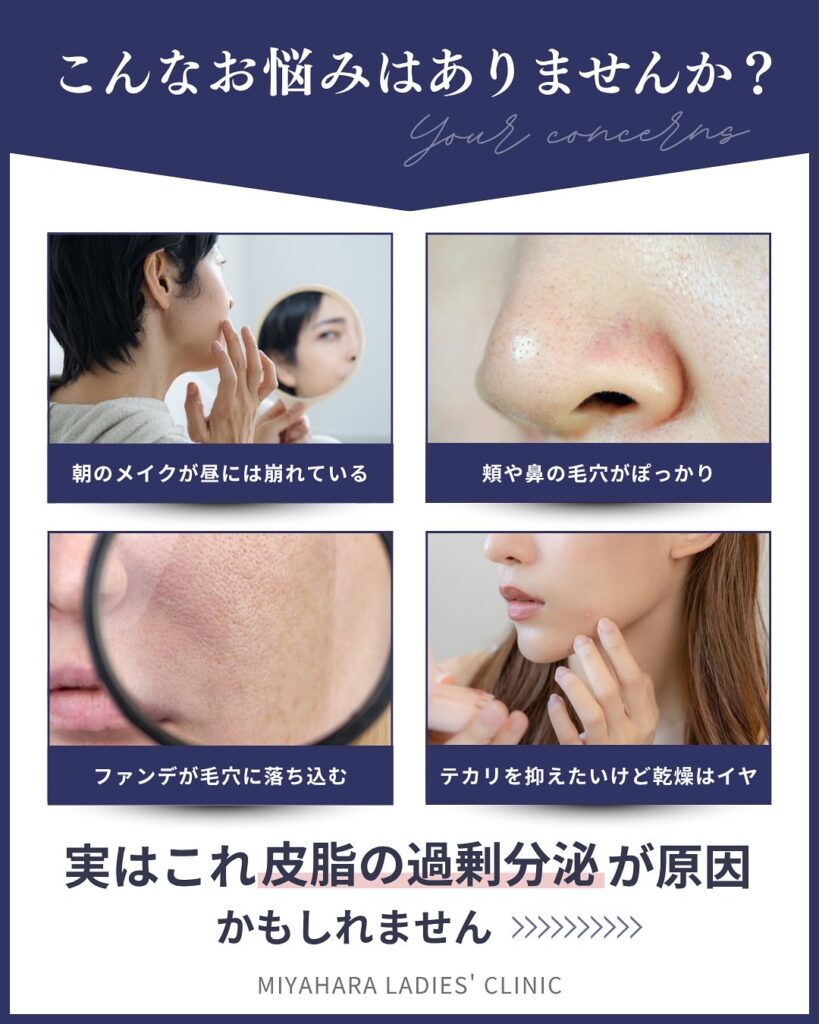 スキンボトックスによる毛穴・皮脂・小ジワ改善を解説する美容医療クリニックの記事画像