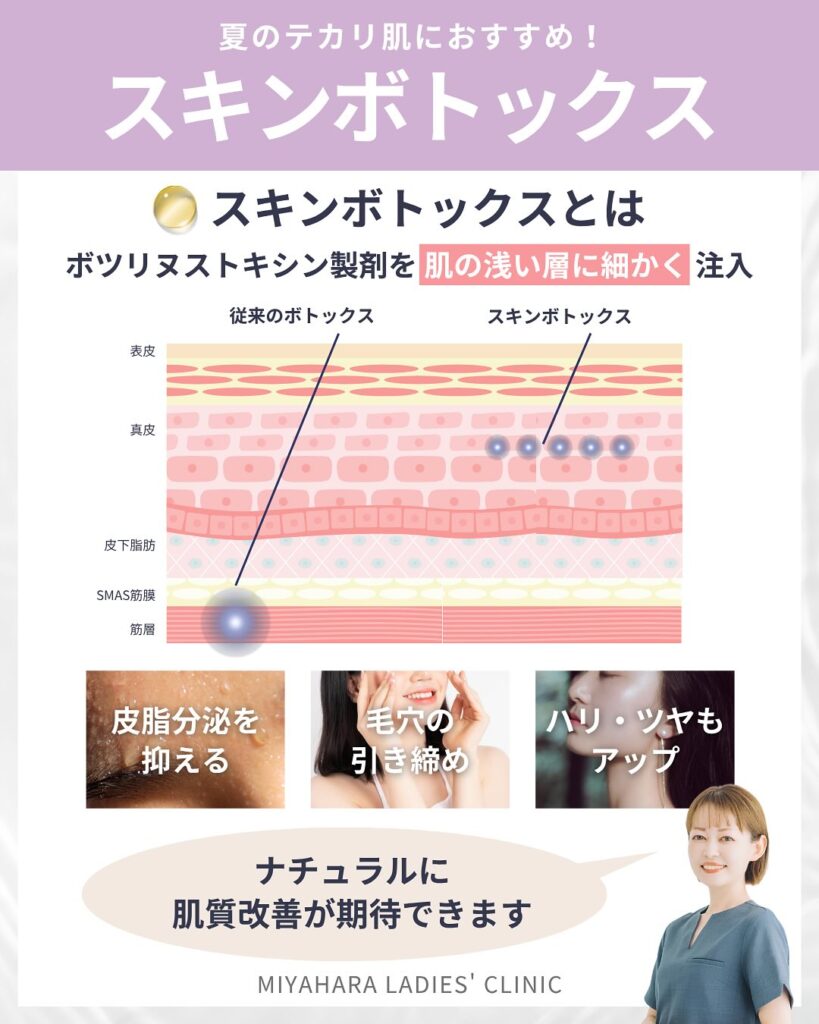 スキンボトックスによる毛穴・皮脂・小ジワ改善を解説する美容医療クリニックの記事画像